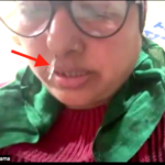 Amazing recovery in a case of CSF Rhinorrhea from Delhi